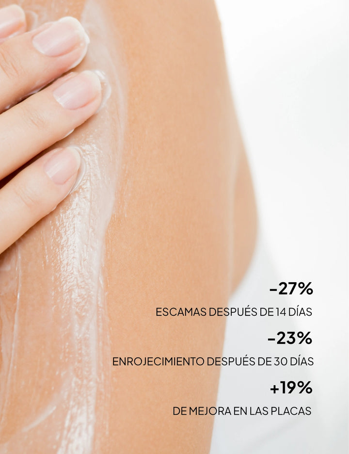 Al usar Psoriasis Xerial Dm 200ml obtendrás los siguientes beneficios: -27% de escamas después de 14 días, -23% de enrojecimiento después de 30 días y +19% de mejora en las placas